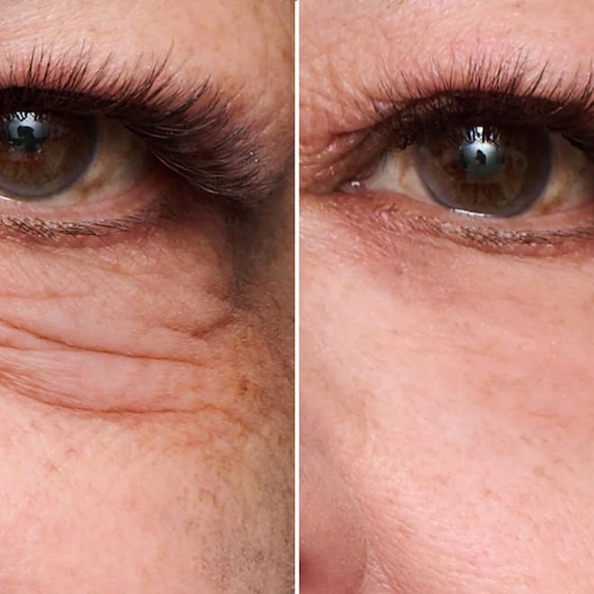 Restock! Peter Thomas Roth's Instant FIRMx Eye Temporary Eye Tightener